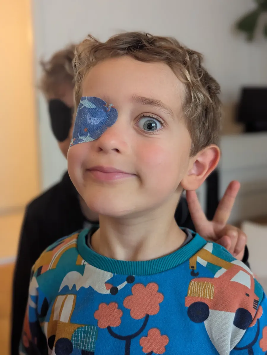 Nahaufnahme von Rickys Auge ohne Prothese